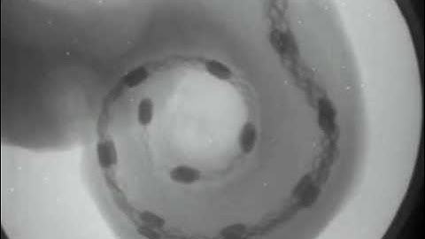 Cochlear Implant Surgery X-Ray Fluoroscopy Video—MED-EL