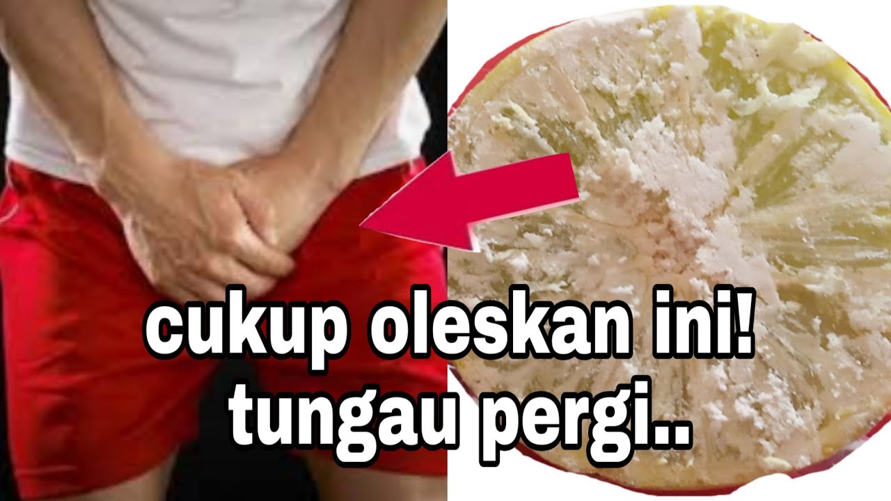 CARA MENGOBATI GIGITAN TUNGAU 