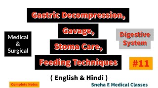 Gastric Decompression, Gavage, Stoma Care and Feeding Techniques in hindi !! Adult Health Nursing !!