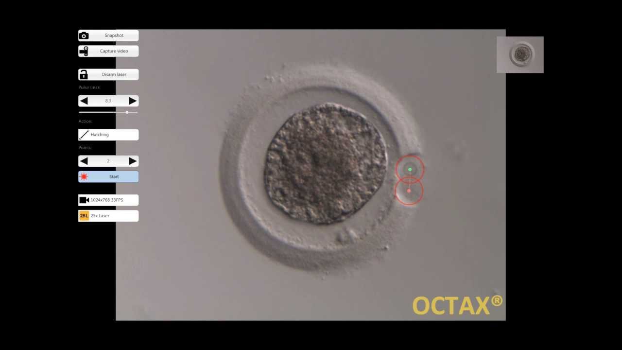 OCTAX NaviLase - Hatching - YouTube