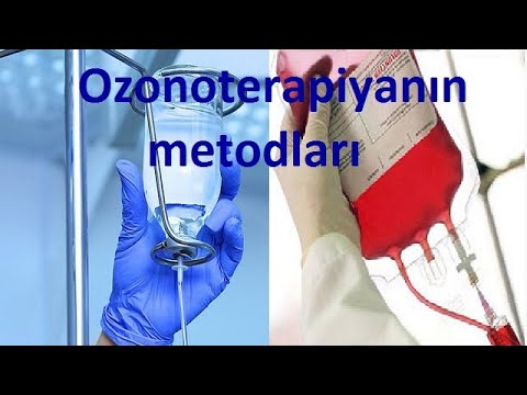 Ozonoterapiyanın sistem təsirli metodları və müalicəvi effektləri.