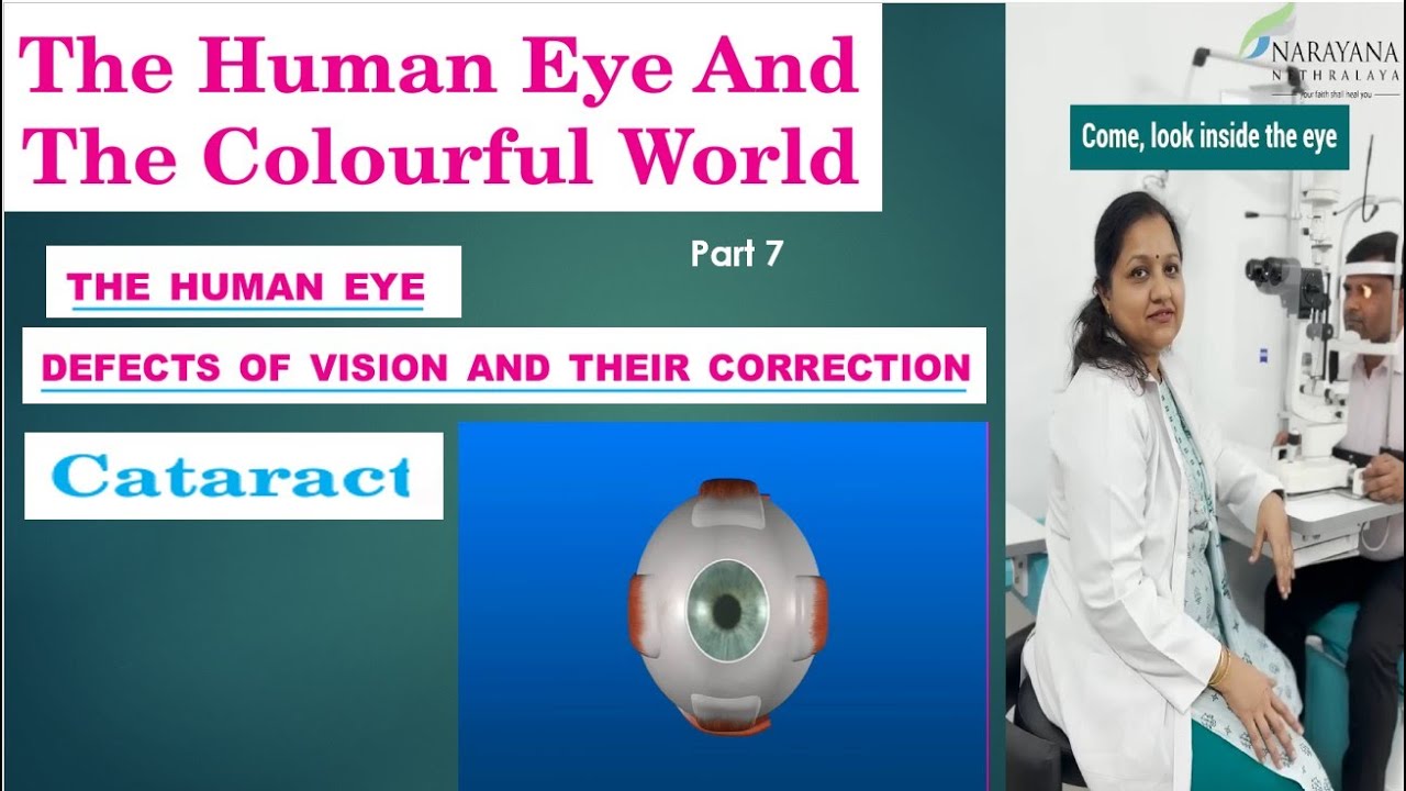 cataract | defect of vision |old age problem| surgical solution