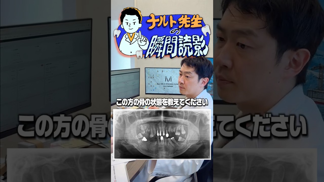ボロボロだけどオールオン４可能！ナルト先生の瞬間読影③
