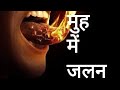 Causes of burning sensation in mouth | मुह मे जलन के कारण