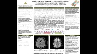 ACP Georgia Poster Presentation 2021