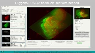 Celebrity Huygens Deconvolution and Fusion of Light-Sheet data (demo). Wealth