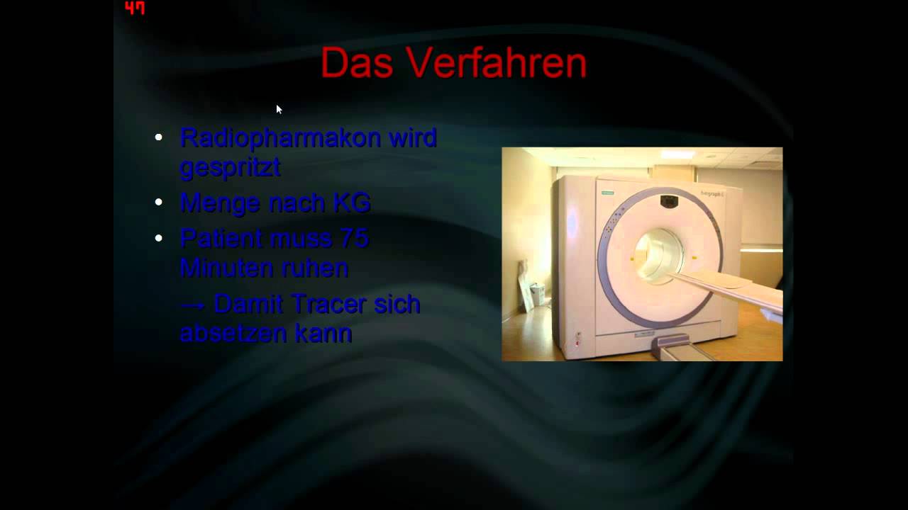 Let's Klugscheiß - Das Original - Positronen Emissions Tomographie ...