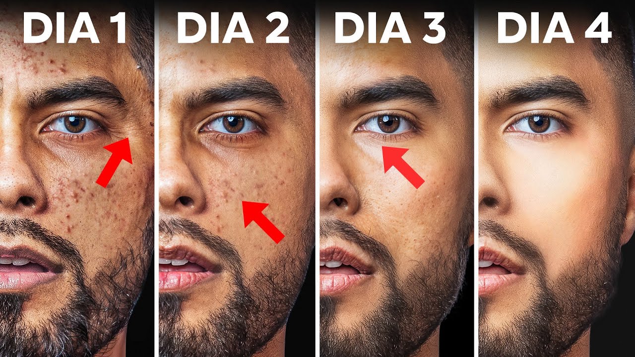 Cómo Arreglar Tu Piel En 4 días Con Productos De Casa