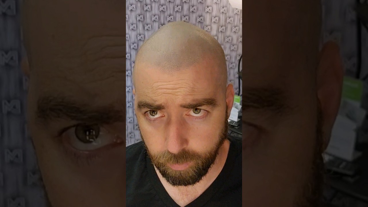 remove shine from anywhere! ...anywhere.  Zero Shine for smp scalp micropigmentation bald head.