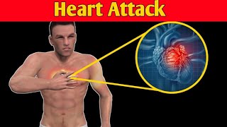Heart Attack (in Urdu/Hindi) | What happens during a Heart Attack? | Heart Attack Reasons, Symptoms