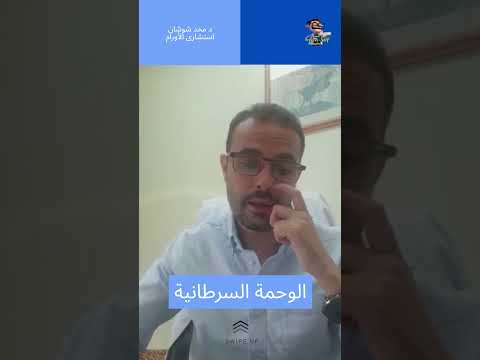 الشامة السرطانية كيف اعرفها اهلا يا دكتور