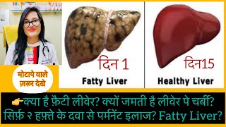 लीवेर पे चर्बी ? Fatty Liver Disease Homeopathic Treatment- Fatty liver Top Homeopathic Medicine