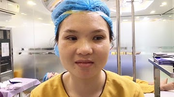 Xem Tận Mắt Đường Cắt Mí Mani Open Deep 5D Tại Dr.Hải Lê.