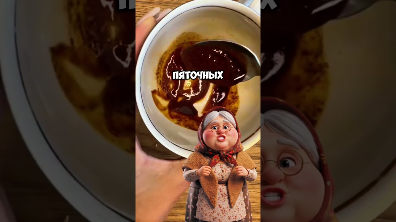 Домашний рецепт от пяточных шпор с йодом и мёдом #народнаямедицина #лайфхаки #рецепты