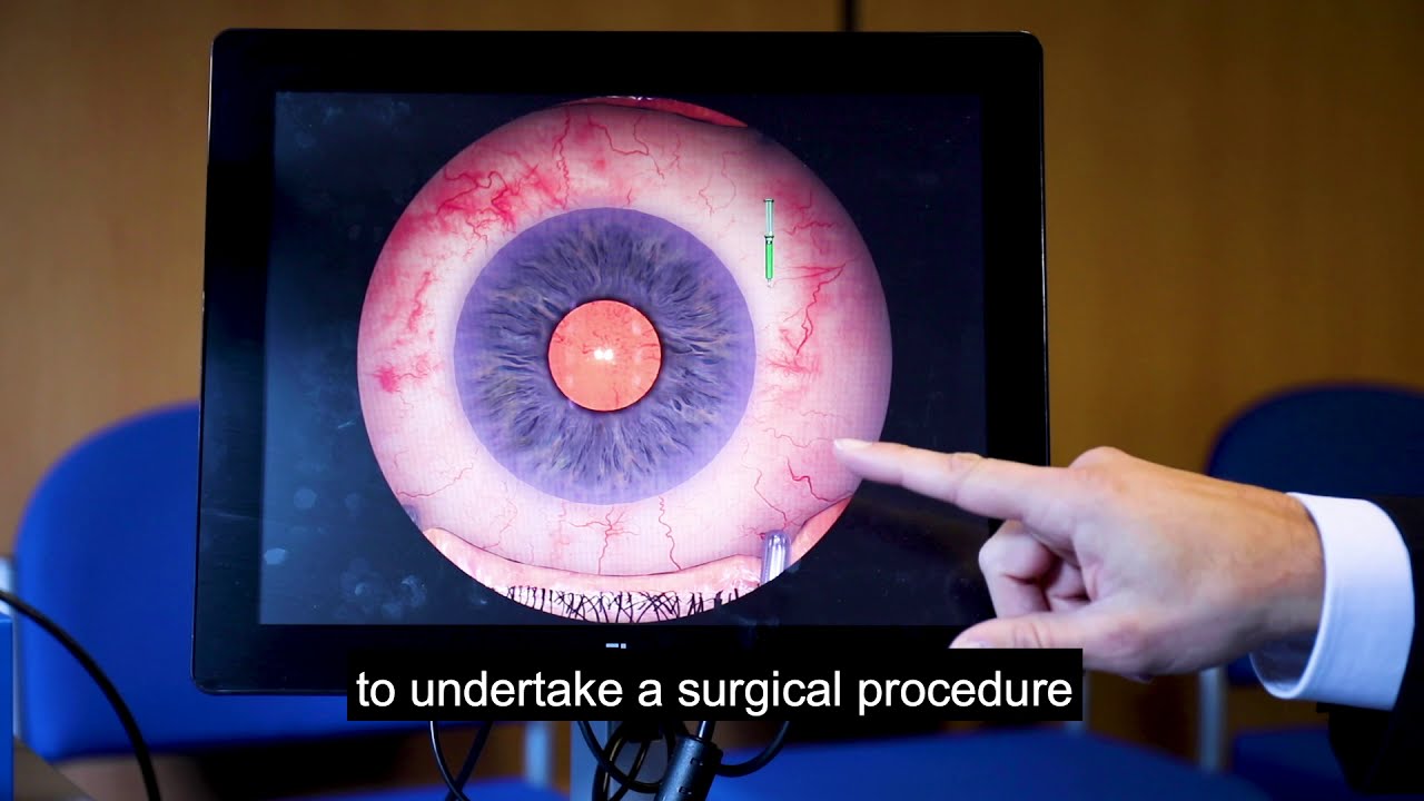 Moorfields Eye Charity eye simulator YouTube