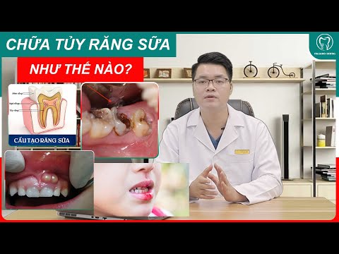 Video [ KIẾN THỨC NHA KHOA] Điều trị tủy răng sữa như thế... - youtube