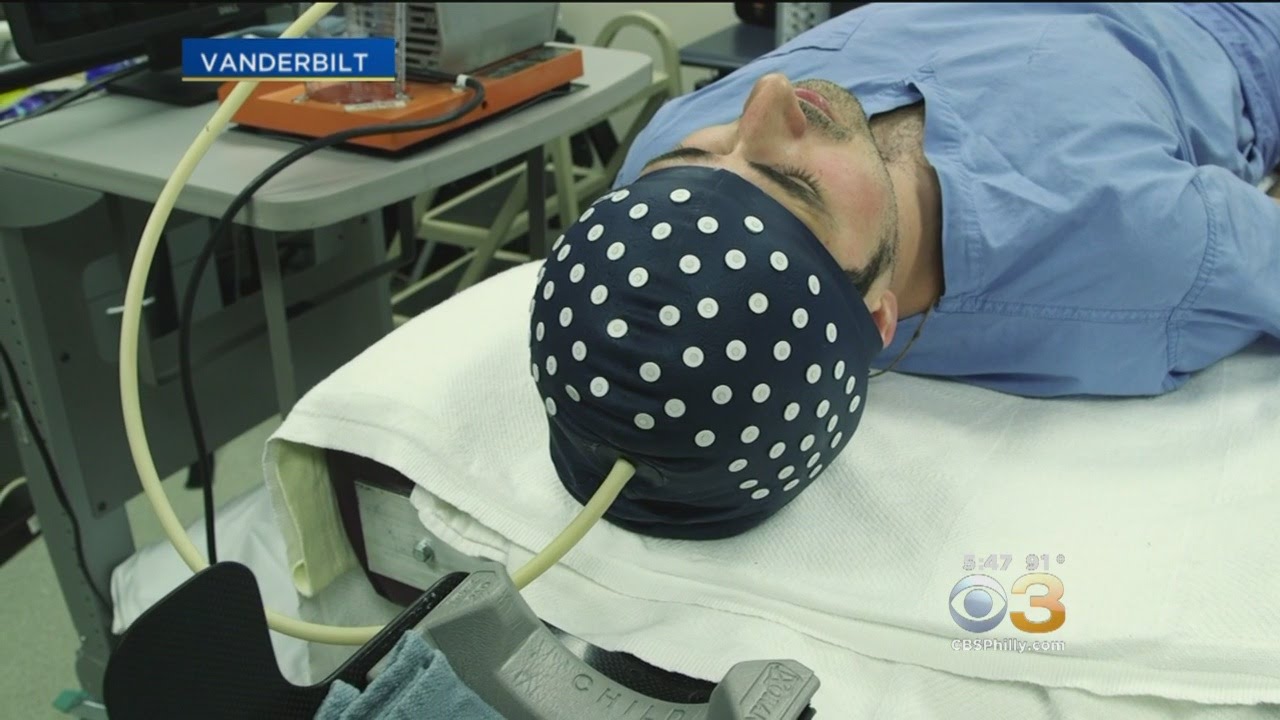 Scientists Developing Surgical Helmet Made Out Of Coffee Grounds