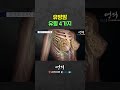 유방암 유형 4가지 알려드립니다✔️