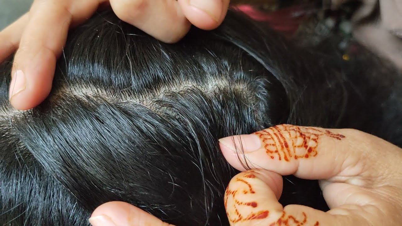 Lice Nits Picking on Black Curly Hairs ASMR Pakistan YouTube
