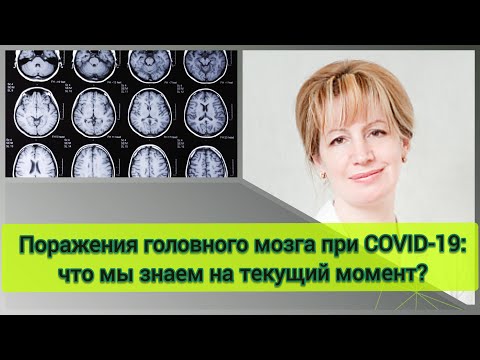 Поражения головного мозга при COVID-19:   что мы знаем на текущий момент?