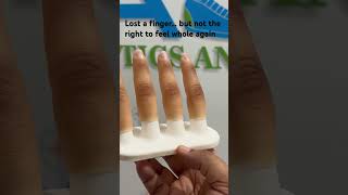 Hyper-Realistic Prosthetic Fingers | Restoring Lives with Science & Art