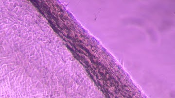 Cell detachment for temperature responsive polymers