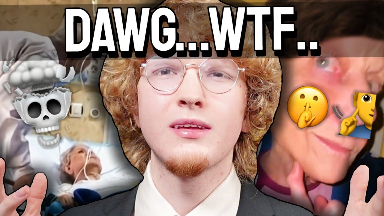 Why is Everything a Sigma Edit?..