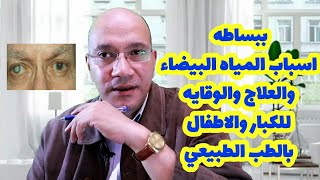 المياه البيضاء وأسبابها /العلاج والوقايه بالطب الطبيعي