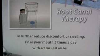 ROOT CANAL POST OP INSTRUCTIONS
