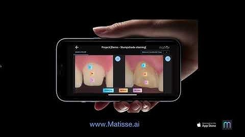 Matisse iOS app - Stain the stump shade