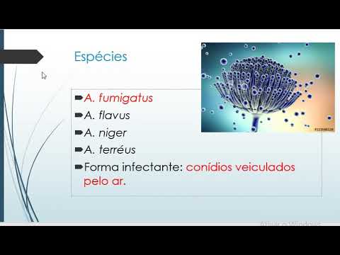 Vídeo: Aspergilose Broncopulmonar Alérgica: Causas E Diagnóstico