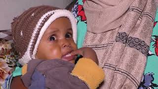 Life Saving Impact Of Therapeutic Feeding For Malnourished Children In Adi Tekelezan
