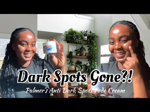 Palmer’s Anti Dark Spot Cream Review | Does It Really Work? | Honest Skincare Test || 2025