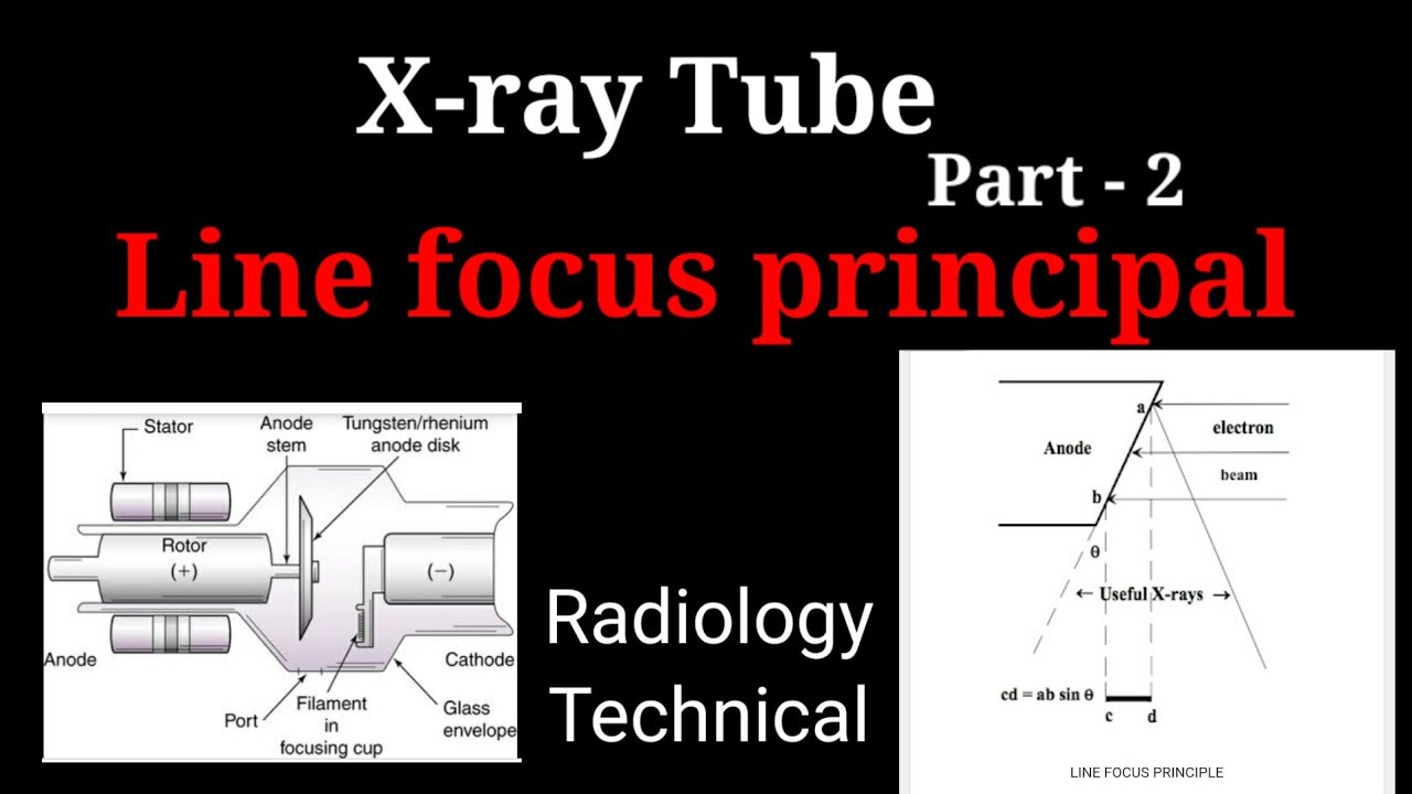 Line focus principal Xray tube Part 2 Definition & Advantage