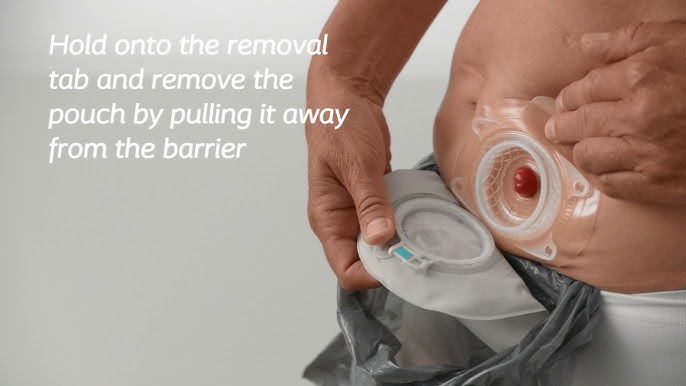 ESENTA™, silicone-based skin protection & adhesive removal