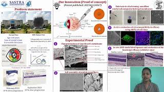 Doctoral Research Spotlight | Injectable Hydrogels for AMD | Dr. Shambhavi Bagewadi