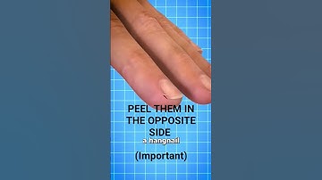 Thumbnail of Peel Them In The Opposite Side (This Will Not Hurt) #hangnail #pain