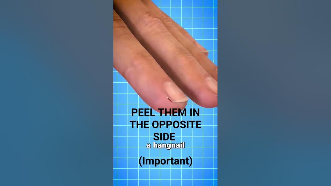 Peel Them In The Opposite Side (This Will Not Hurt) #hangnail #pain Peel Them In The Opposite Side (This Will Not Hurt) #hangnail #pain