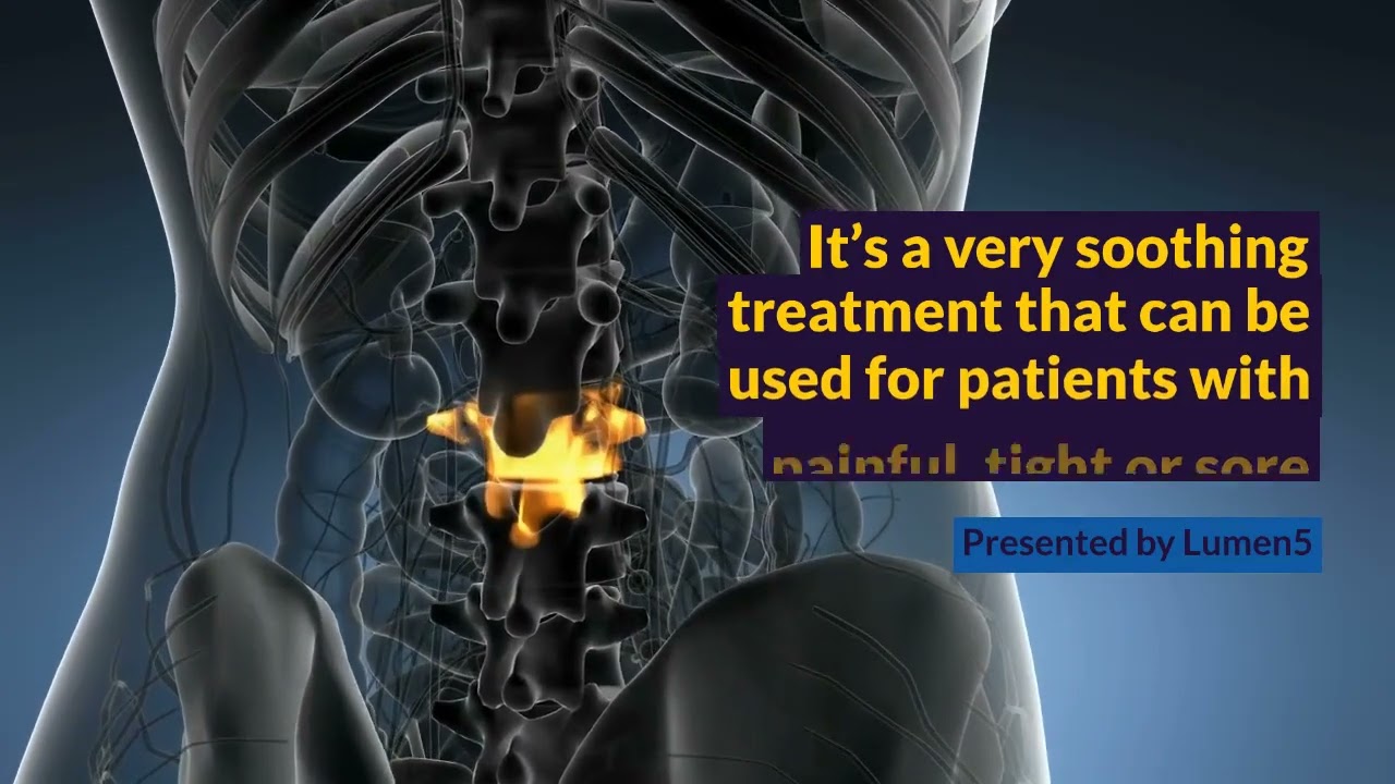 Treatment with the DRX9000 Easily Explained YouTube