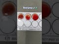 #ब्लड ग्रुप कैसे पता करें|#doctor #medicalstudent #bloodgroup #bloodgrouptest #hospital #shortsfeed