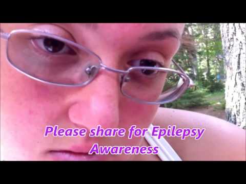 15 minute Absence Seizure - Status Epilepticus - how long are your Seizures? - Comment below