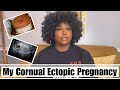 My cornual ectopic pregnancy  salpingectomy story  queen javon