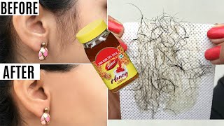 In 2 Minutes, Remove Unwanted Hair Permanently || No Shave || No wax