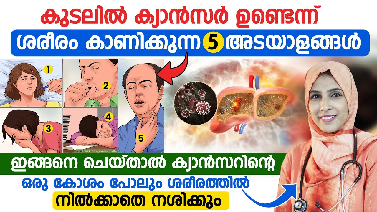 ഈ 5 ലക്ഷണങ്ങൾ നിങ്ങളിൽ ഉണ്ടോ?കുടൽ ക്യാൻസർ വരാനുള്ള കാരണങ്ങൾ|വരാതിരിക്കാൻ ശ്രദ്ധിക്കേണ്ട കാര്യങ്ങൾ