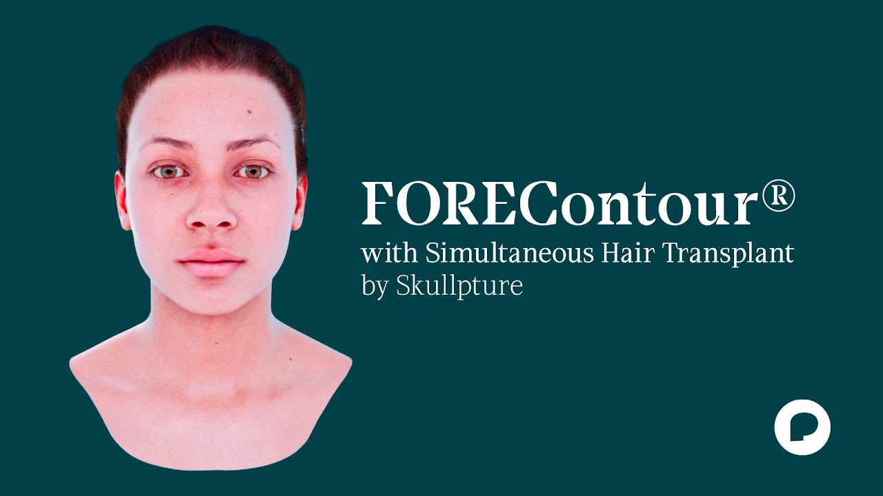 FOREContour® | Envisioning Forehead Surgery