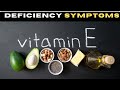 VITAMIN E DEFICIENCY SYMPTOMS || Top 10 deficiency sign and symptoms of vitamin E #vitamine