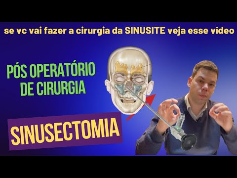 Pós-operatório da cirurgia de sinusite (sinusectomia)