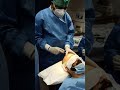 Hair transplant Treatment in Bangalore-Dr.Parthasarathi