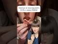 Как лечить СТОМАТИТ