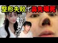 美容整形失敗で鼻先が壊死!元には戻らない。中国の女優がSNSで公表!韓国でも論争に。整形の危険性を考える。